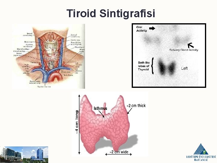 Tiroid Sintigrafisi 