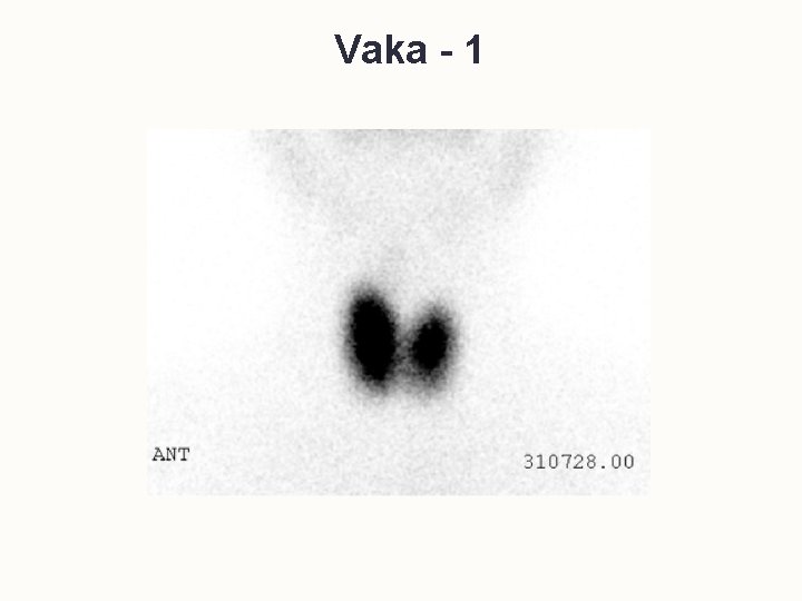Vaka - 1 