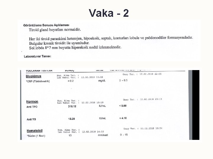 Vaka - 2 