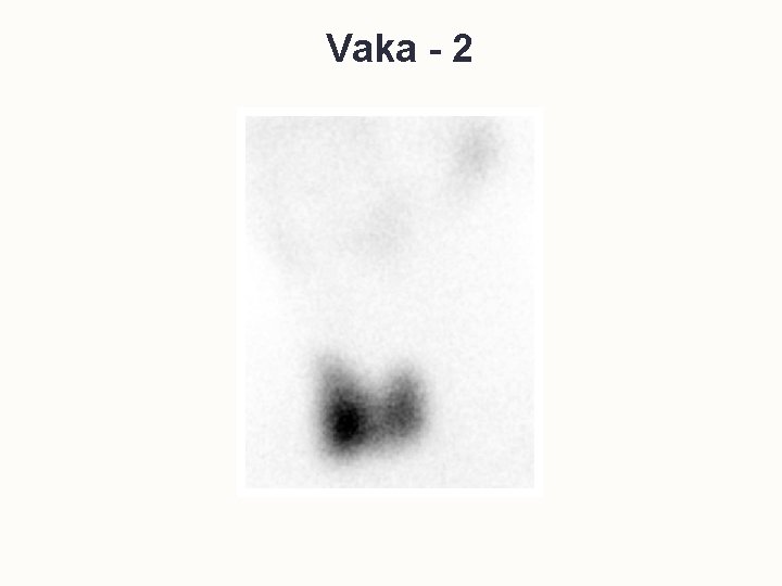 Vaka - 2 