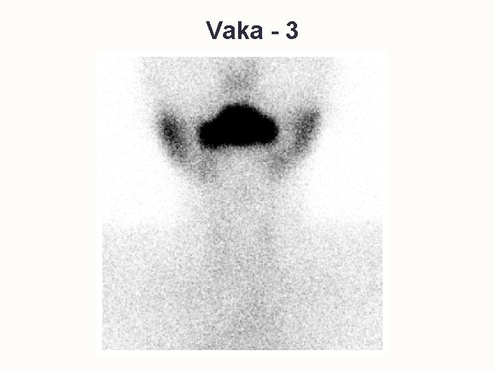 Vaka - 3 
