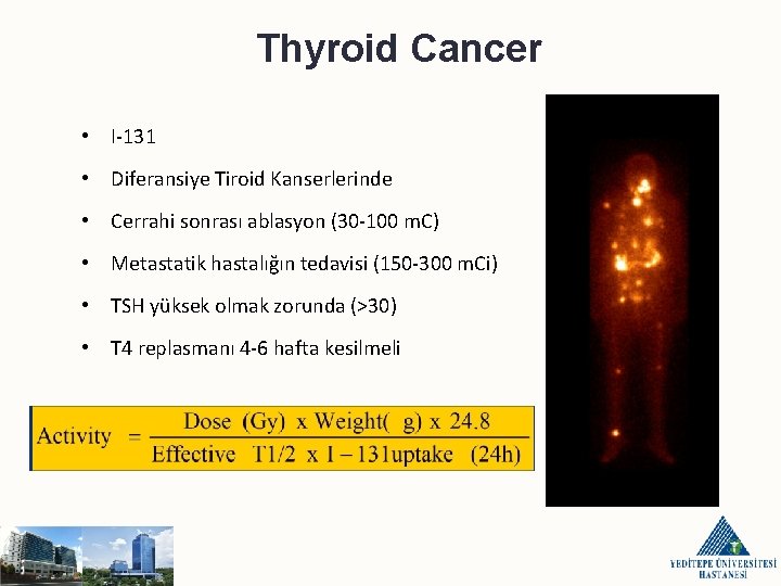 Thyroid Cancer • I-131 • Diferansiye Tiroid Kanserlerinde • Cerrahi sonrası ablasyon (30 -100