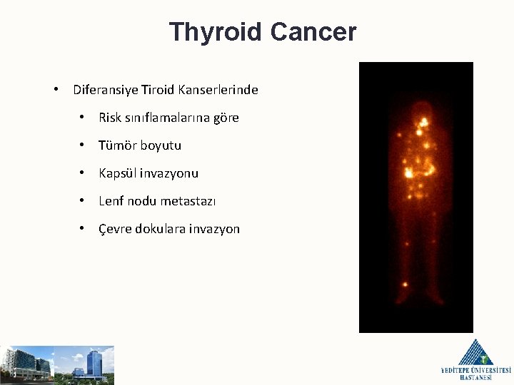 Thyroid Cancer • Diferansiye Tiroid Kanserlerinde • Risk sınıflamalarına göre • Tümör boyutu •