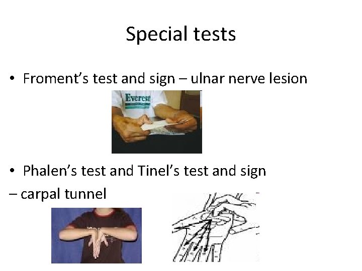 Special tests • Froment’s test and sign – ulnar nerve lesion • Phalen’s test