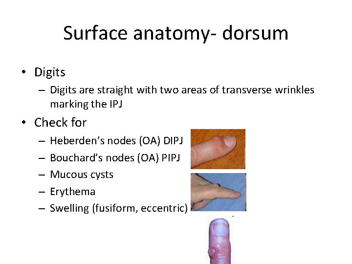 Surface anatomy- dorsum • Digits – Digits are straight with two areas of transverse