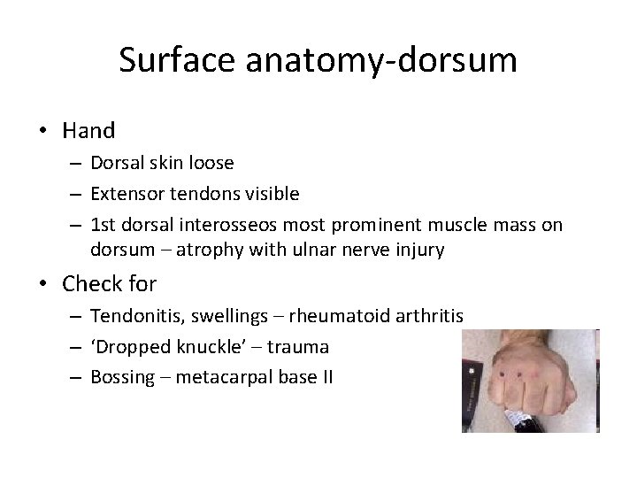 Surface anatomy-dorsum • Hand – Dorsal skin loose – Extensor tendons visible – 1