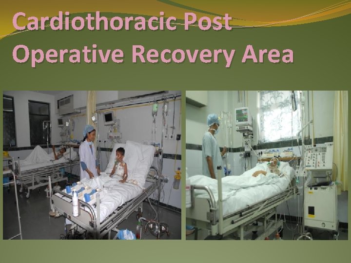 Cardiothoracic Post Operative Recovery Area 