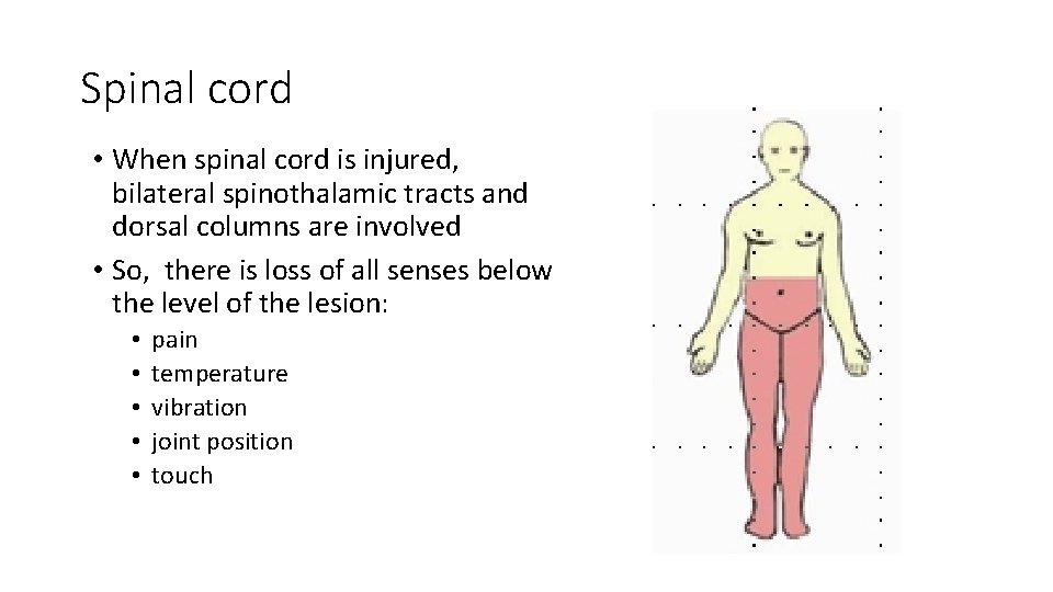 Spinal cord • When spinal cord is injured, bilateral spinothalamic tracts and dorsal columns