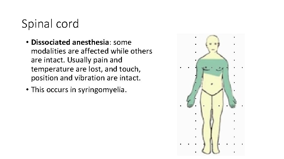 Spinal cord • Dissociated anesthesia: some modalities are affected while others are intact. Usually