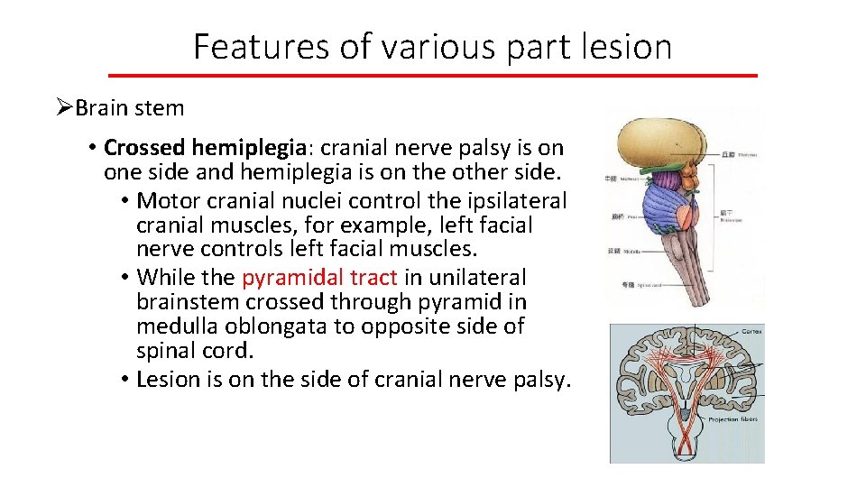 Features of various part lesion ØBrain stem • Crossed hemiplegia: cranial nerve palsy is