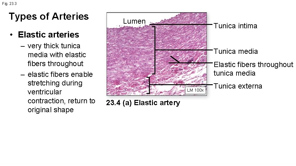 Fig. 23. 3 Types of Arteries Lumen Tunica intima • Elastic arteries – very