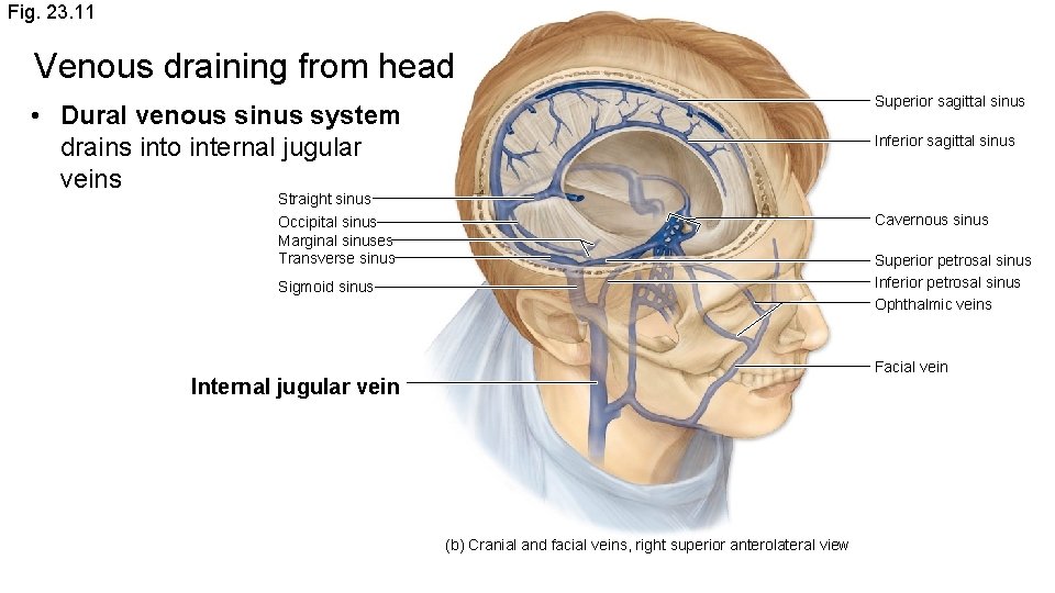 Fig. 23. 11 Venous draining from head Superior sagittal sinus • Dural venous sinus