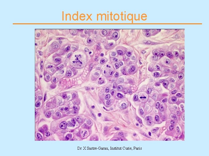 Index mitotique Dr X Sastre-Garau, Institut Curie, Paris 