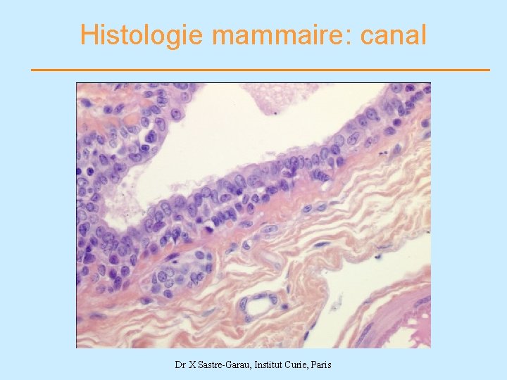 Histologie mammaire: canal Dr X Sastre-Garau, Institut Curie, Paris 