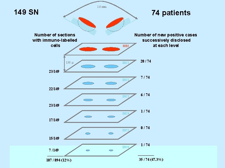 1. 8 mm 149 SN 74 patients Number of sections with immuno-labelled cells 150