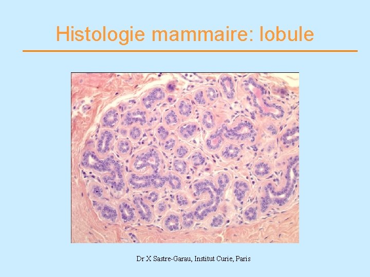 Histologie mammaire: lobule Dr X Sastre-Garau, Institut Curie, Paris 