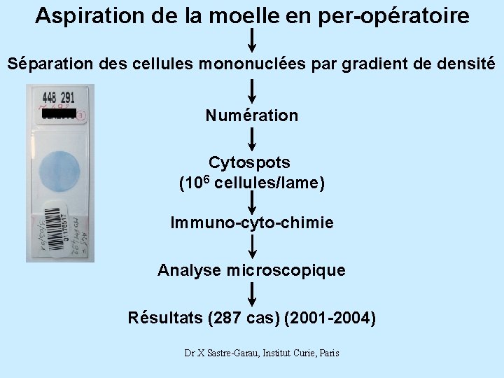Aspiration de la moelle en per-opératoire Séparation des cellules mononuclées par gradient de densité