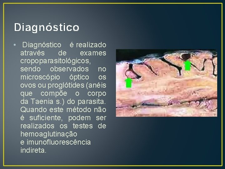 Diagnóstico • Diagnóstico é realizado através de exames cropoparasitológicos, sendo observados no microscópio óptico