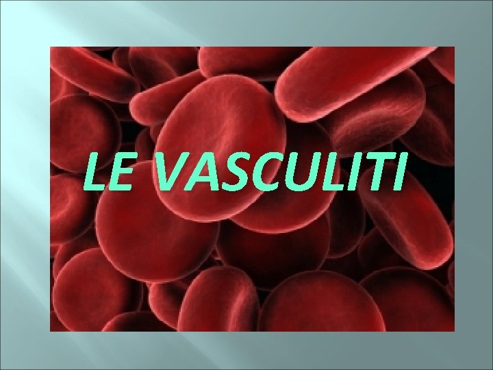 LE VASCULITI 