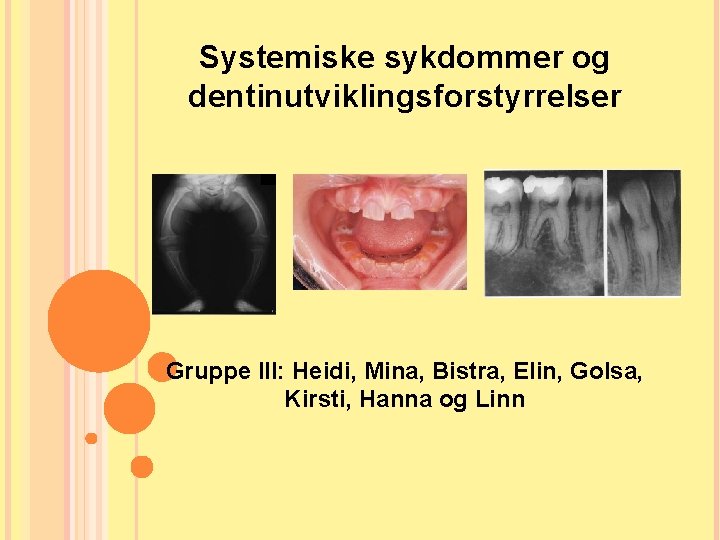 Systemiske sykdommer og dentinutviklingsforstyrrelser Gruppe III: Heidi, Mina, Bistra, Elin, Golsa, Kirsti, Hanna og Systemiske sykdommer og dentinutviklingsforstyrrelser Gruppe III: Heidi, Mina, Bistra, Elin, Golsa, Kirsti, Hanna og