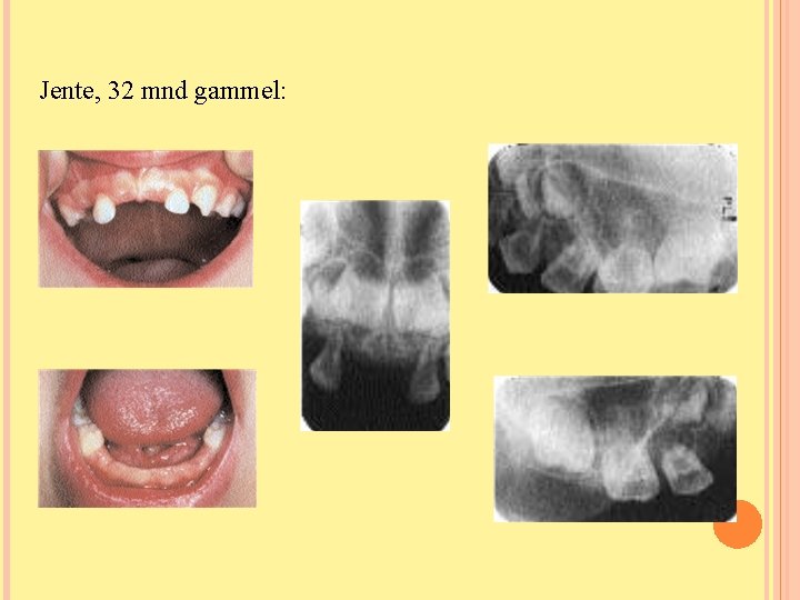 Jente, 32 mnd gammel: Jente, 32 mnd gammel: