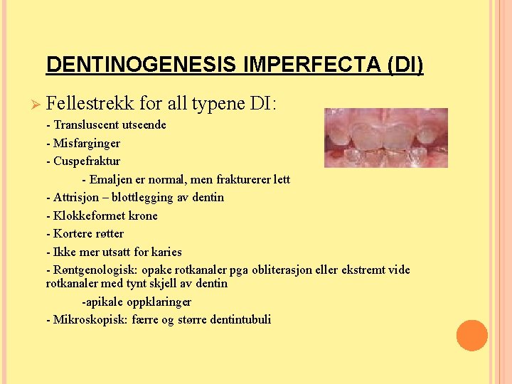 DENTINOGENESIS IMPERFECTA (DI) Ø Fellestrekk for all typene DI: - Transluscent utseende - Misfarginger DENTINOGENESIS IMPERFECTA (DI) Ø Fellestrekk for all typene DI: - Transluscent utseende - Misfarginger