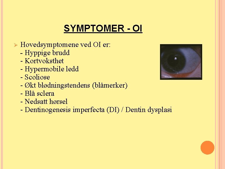 SYMPTOMER - OI Ø Hovedsymptomene ved OI er: - Hyppige brudd - Kortvoksthet - SYMPTOMER - OI Ø Hovedsymptomene ved OI er: - Hyppige brudd - Kortvoksthet -