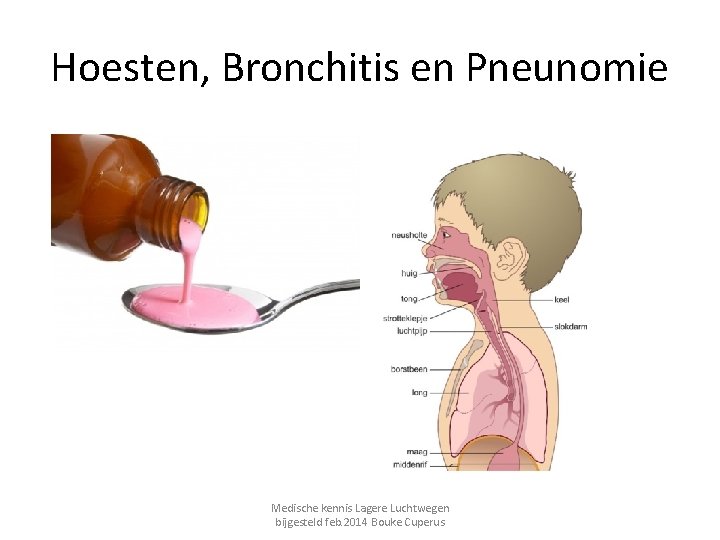 Hoesten, Bronchitis en Pneunomie Medische kennis Lagere Luchtwegen bijgesteld feb. 2014 Bouke Cuperus 