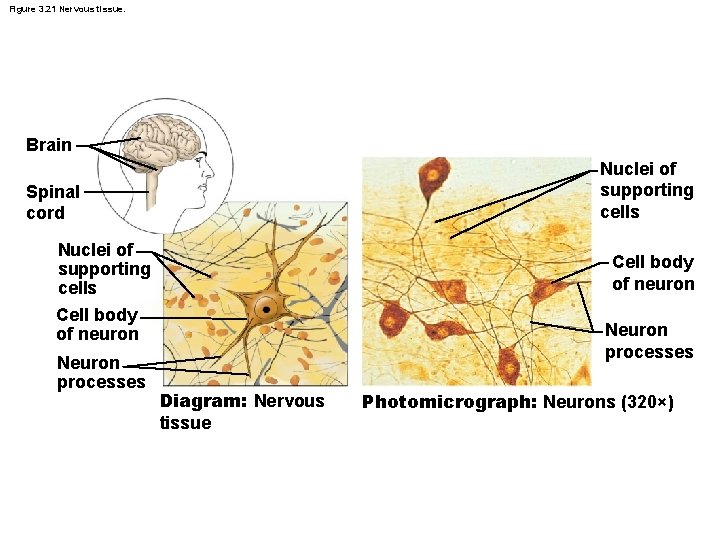 Figure 3. 21 Nervous tissue. Brain Nuclei of supporting cells Spinal cord Nuclei of