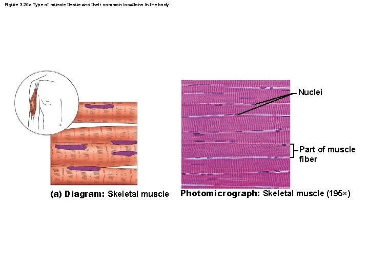 Figure 3. 20 a Type of muscle tissue and their common locations in the