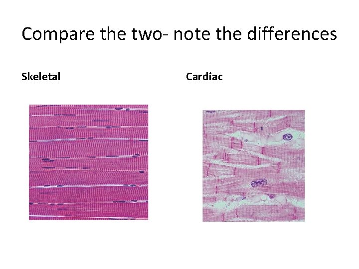 Compare the two- note the differences Skeletal Cardiac 