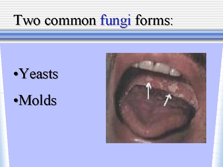 Two common fungi forms: • Yeasts • Molds 