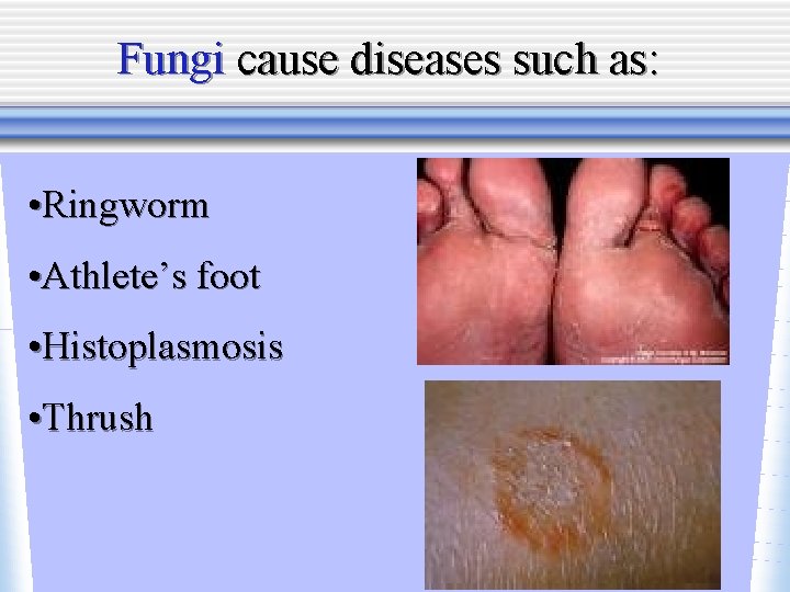 Fungi cause diseases such as: • Ringworm • Athlete’s foot • Histoplasmosis • Thrush