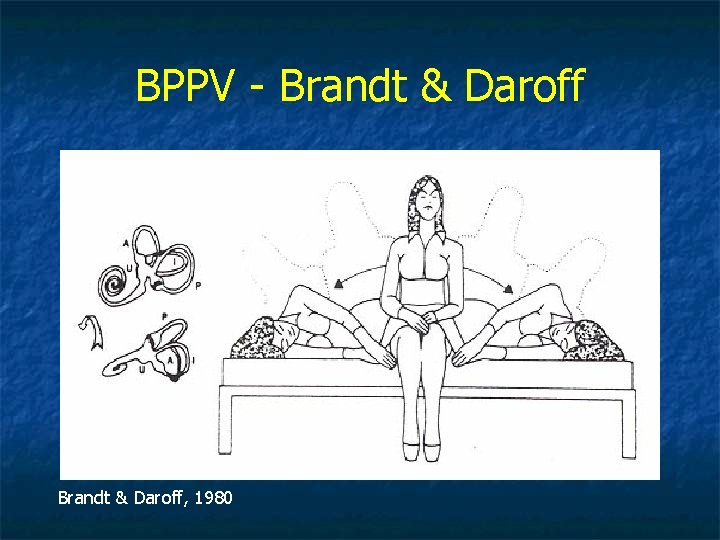 BPPV - Brandt & Daroff, 1980 
