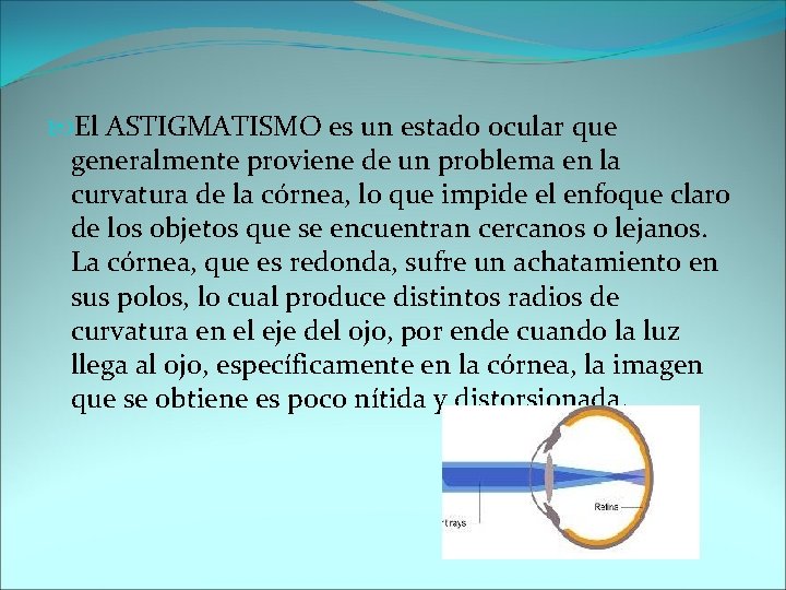 El ASTIGMATISMO es un estado ocular que generalmente proviene de un problema en El ASTIGMATISMO es un estado ocular que generalmente proviene de un problema en