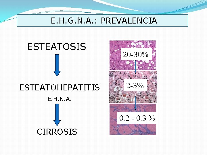 E. H. G. N. A. : PREVALENCIA ESTEATOSIS ESTEATOHEPATITIS 20 -30% 2 -3% E.