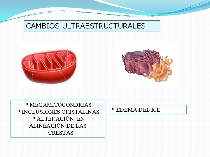CAMBIOS ULTRAESTRUCTURALES * MEGAMITOCONDRIAS * INCLUSIONES CRISTALINAS * ALTERACIÓN EN ALINEACIÓN DE LAS CRESTAS