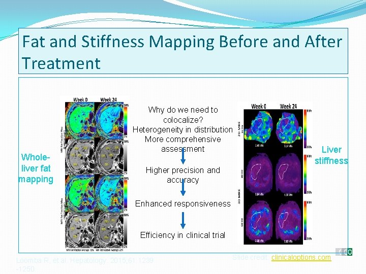 Fat and Stiffness Mapping Before and After Treatment Wholeliver fat mapping Why do we