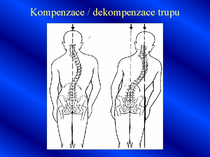 Kompenzace / dekompenzace trupu 