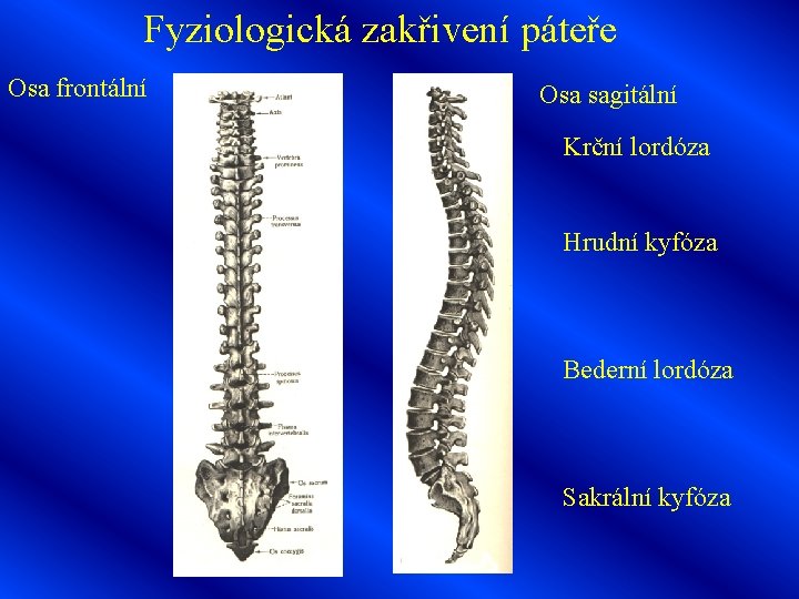 Fyziologická zakřivení páteře Osa frontální Osa sagitální Krční lordóza Hrudní kyfóza Bederní lordóza Sakrální