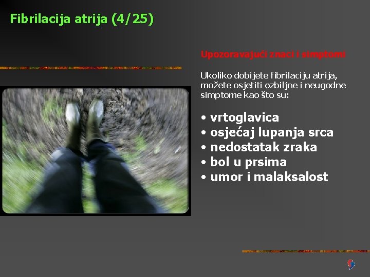 Fibrilacija atrija (4/25) Upozoravajući znaci i simptomi Ukoliko dobijete fibrilaciju atrija, možete osjetiti ozbiljne