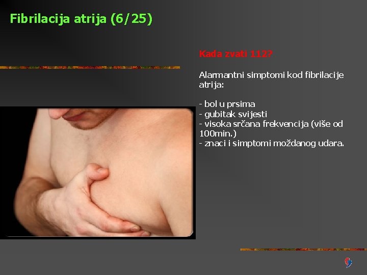 Fibrilacija atrija (6/25) Kada zvati 112? Alarmantni simptomi kod fibrilacije atrija: - bol u