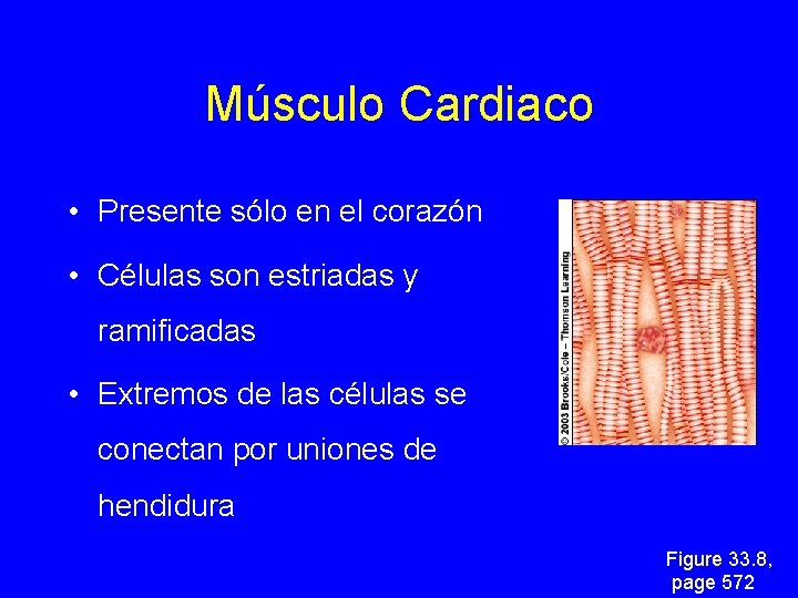 Músculo Cardiaco • Presente sólo en el corazón • Células son estriadas y ramificadas