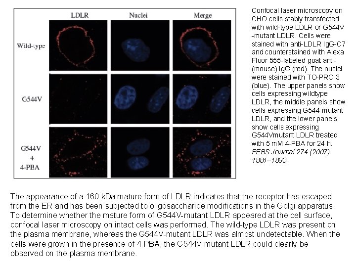 Confocal laser microscopy on CHO cells stably transfected with wild-type LDLR or G 544