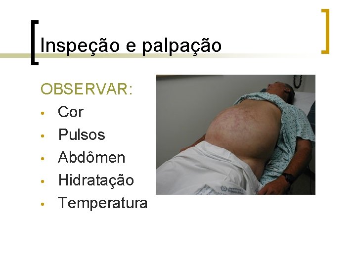 Inspeção e palpação OBSERVAR: • Cor • Pulsos • Abdômen • Hidratação • Temperatura Inspeção e palpação OBSERVAR: • Cor • Pulsos • Abdômen • Hidratação • Temperatura