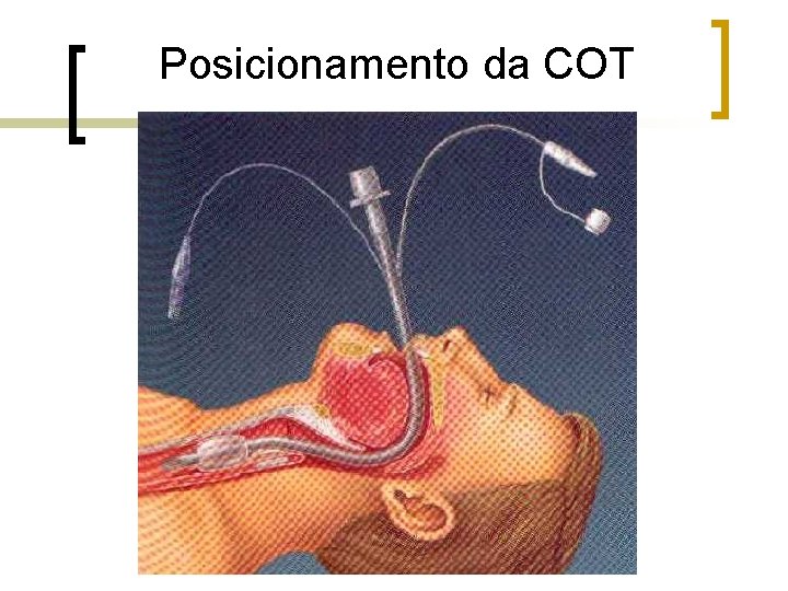 Posicionamento da COT Posicionamento da COT