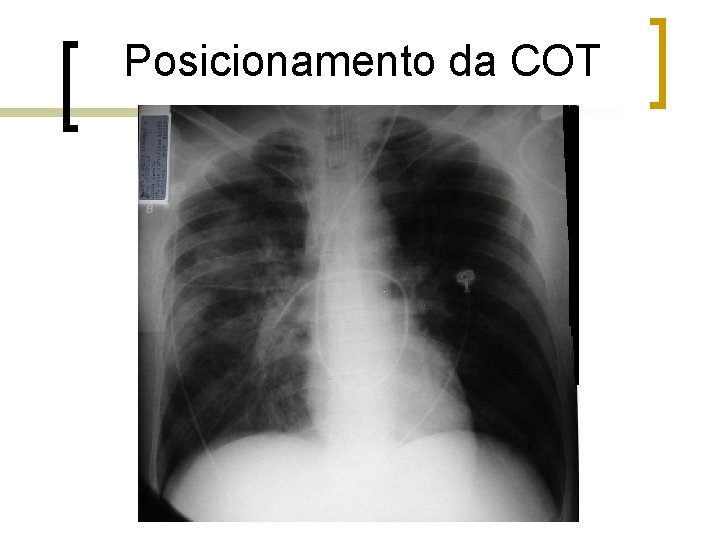 Posicionamento da COT Posicionamento da COT