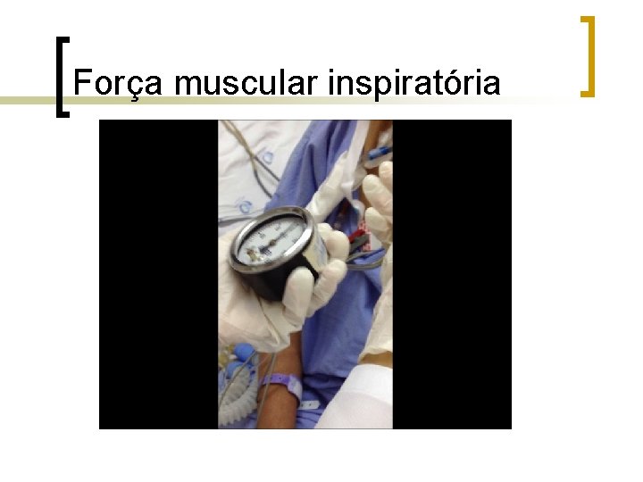 Força muscular inspiratória Força muscular inspiratória