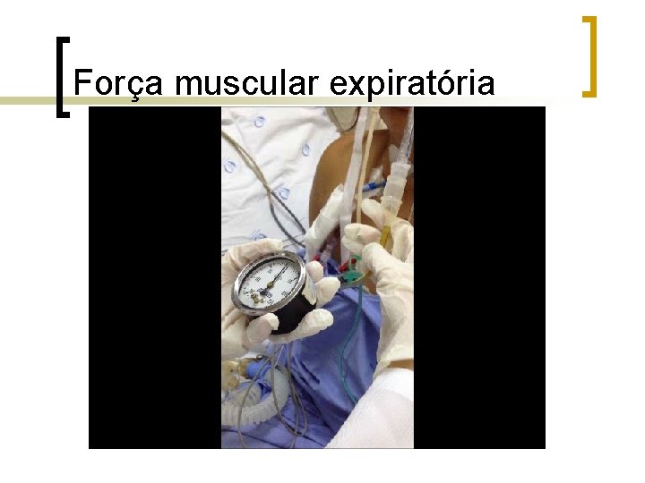 Força muscular expiratória Força muscular expiratória