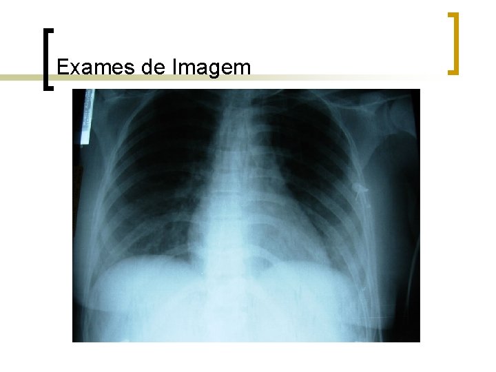 Exames de Imagem Exames de Imagem